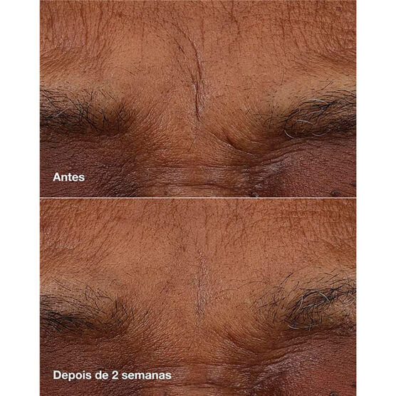 Balm Pro Idade Clinique Smart&trade; Retin&oacute;ide